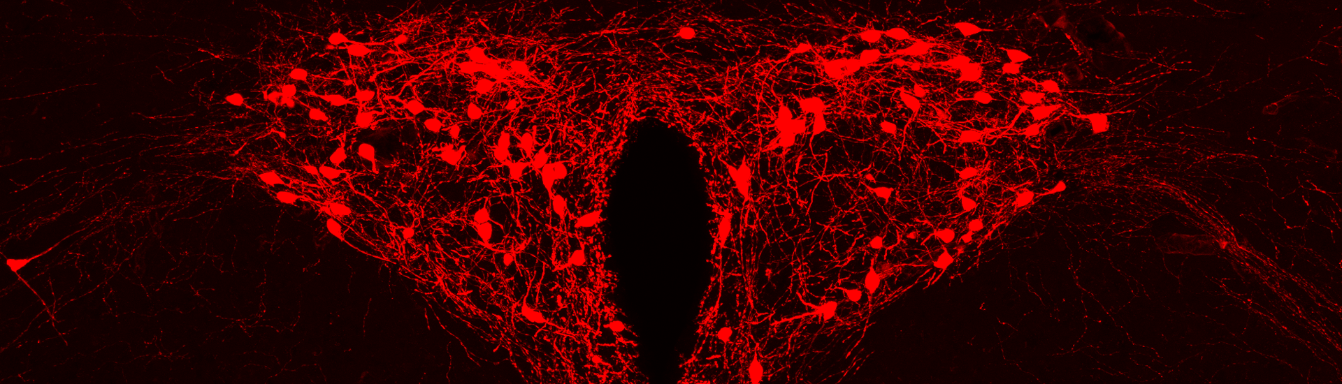 《科學》發(fā)表中科院腦智卓越中心關(guān)于癢覺傳導機制的研究成果